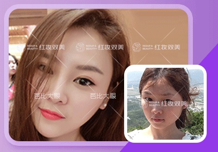 【速美项目】芭比大眼