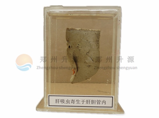 寄生虫大体标本