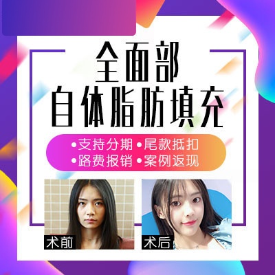 自体脂肪填充