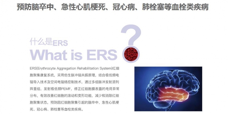 什么是ERS